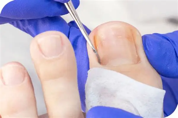 ¿Cada cuánto debo asistir ir al podólogo?